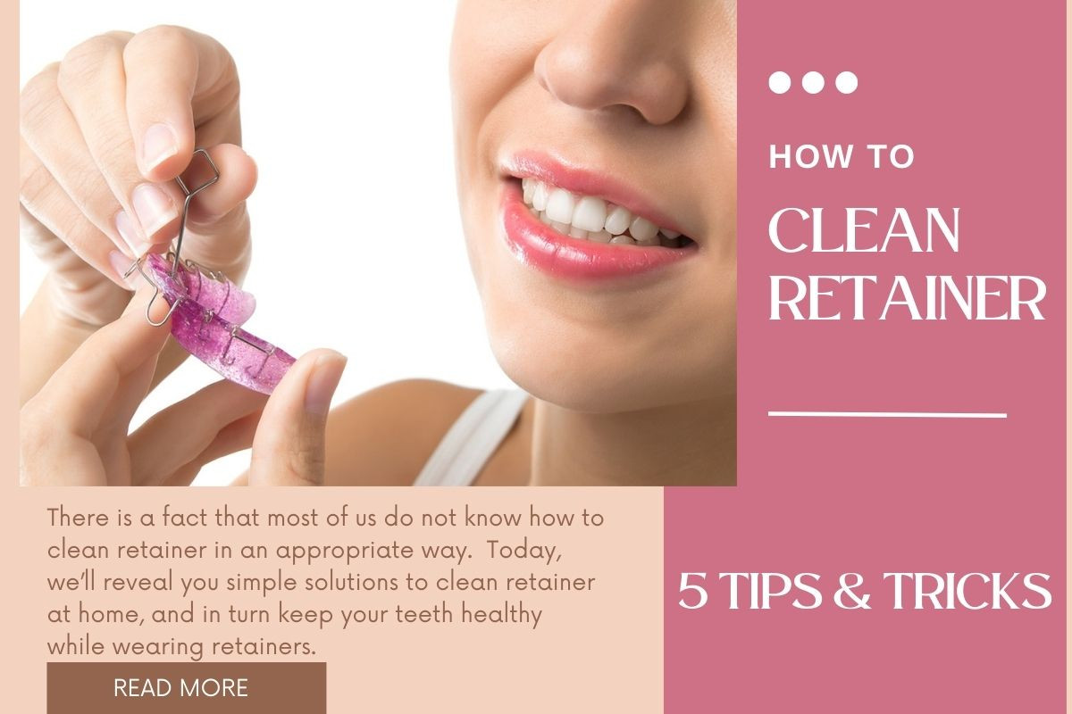 How to clean retainer at home 5 simple tips anyone can stick to it